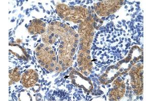 GTF3C5 antibody was used for immunohistochemistry at a concentration of 4-8 ug/ml to stain EpitheliaI cells of renal tubule (arrows) in Human Kidney. (GTF3C5 anticorps  (N-Term))