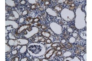 Formalin-fixed and paraffin embedded rat kidney tissue labeled with Anti-Phospho-c-Kit(Tyr721) Polyclonal Antibody, Unconjugated  followed by conjugation to the secondary antibody and DAB staining