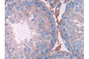 Detection of JAK2 in Rat Testis Tissue using Polyclonal Antibody to Janus Kinase 2 (JAK2)