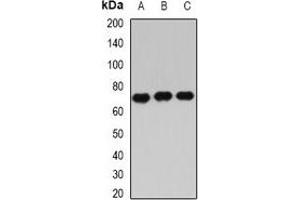 Western blot analysis of IGF2BP3 expression in Hela (A), PC3 (B), NIH3T3 (C) whole cell lysates. (IGF2BP3 anticorps)