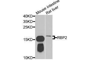 Western blot analysis of extracts of various cell lines, using RBP2 antibody.