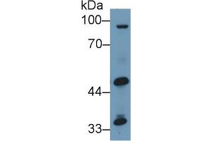 Detection of ALT2 in Human HepG2 cell lysate using Polyclonal Antibody to Alanine Aminotransferase 2 (ALT2)