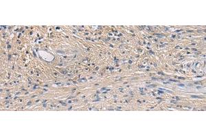 Immunohistochemistry of paraffin-embedded Human brain tissue using PA2G4 Polyclonal Antibody at dilution of 1:60(x200) (PA2G4 anticorps)