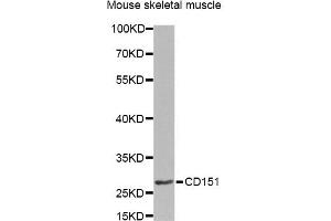 Western blot analysis of extracts of mouse skeletal muscle, using CD151 Antibody. (CD151 anticorps)