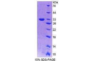 SDS-PAGE (SDS) image for Guanylate Binding Protein 6 (GBP6) (AA 35-277) protein (His tag) (ABIN6239549)