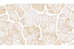 Detection of ACTN3 in Human Skeletal muscle Tissue using Polyclonal Antibody to Actinin Alpha 3 (ACTN3)