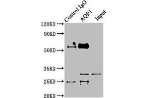 Immunoprecipitating AQP1 in Mouse skeletal muscle tissue Lane 1: Rabbit control IgG instead of ABIN7144499 in Mouse skeletal muscle tissue. (Aquaporin 1 anticorps  (AA 220-269))