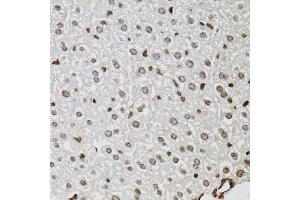 Immunohistochemistry of paraffin-embedded mouse liver using KDM4A antibody. (KDM4A anticorps)