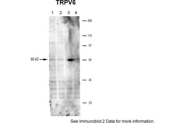 TRPV6 Antikörper  (Middle Region)