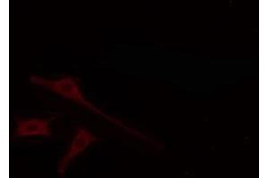 ABIN6274664 staining LOVO cells by IF/ICC.