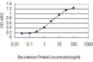 anti-Transformer 2 beta Homolog (TRA2B) (AA 120-199) antibody