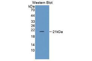 Western blot analysis of the recombinant protein. (FLG2 anticorps  (AA 1222-1368))