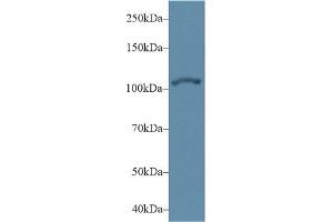 Detection of ACTN2 in Human Hela cell lysate using Polyclonal Antibody to Actinin Alpha 2 (ACTN2)