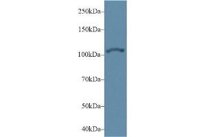Detection of ACTN2 in Human Hela cell lysate using Polyclonal Antibody to Actinin Alpha 2 (ACTN2) (ACTN2 anticorps  (AA 1-254))