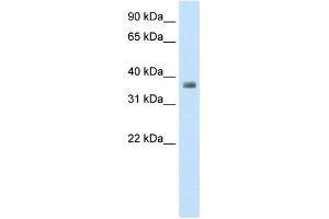 WB Suggested Anti-ZFP36 Antibody Titration:  0. (ZFP36 anticorps  (N-Term))