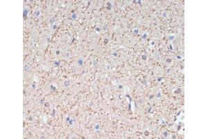 Immunohistochemistry of paraffin-embedded Rat brain using MAG Polyclonal Antibody at dilution of 1:200 (40x lens). (MAG anticorps)