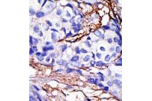 Image no. 2 for anti-RanBP-Type and C3HC4-Type Zinc Finger Containing 1 (RBCK1) (N-Term) antibody (ABIN357475) (RBCK1 anticorps  (N-Term))