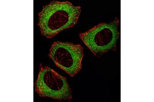 Fluorescent ige of  cell stained with MEK2 (P2K2) Antibody (Center) (ABIN392485 and ABIN2842062)/SA110819AW. (MEK2 anticorps  (AA 262-292))