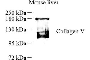 Western blot analysis of collagen alpha-1 (V) (ABIN7073547) at dilution of 1: 500 (Collagen Type V anticorps)
