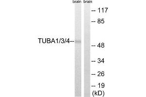 Western Blotting (WB) image for anti-TUBA1/3/4 (Tyr272) antibody (ABIN1848392) (TUBA1/3/4 (Tyr272) anticorps)