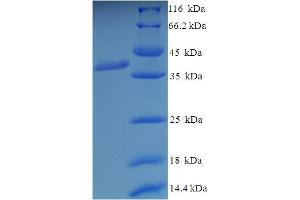 SDS-PAGE (SDS) image for Glutamate Receptor, Ionotropic, Kainate 5 (GRIK5) (AA 143-238), (Extracellular) protein (GST tag) (ABIN5710370)