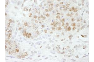 anti-Cleavage and Polyadenylation Specific Factor 3, 73kDa (CPSF3) (AA 634-684) antibody