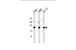 All lanes : Anti-LZIC Antibody (Center) at 1:2000 dilution Lane 1: Hela whole cell lysate Lane 2: K562 whole cell lysate Lane 3: PC-12 whole cell lysate Lysates/proteins at 20 μg per lane. (LZIC anticorps  (AA 81-109))