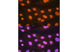 Immunofluorescence analysis of H9C2 cells using POLR2A Rabbit pAb (ABIN3022932, ABIN3022933, ABIN3022934 and ABIN6219303) at dilution of 1:100.