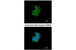ICC/IF Image Immunofluorescence analysis of methanol-fixed A431, using PDI, antibody at 1:200 dilution. (P4HB anticorps)