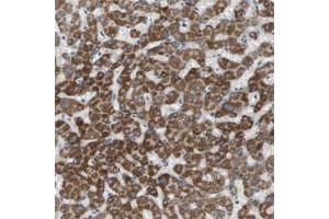 Immunohistochemical staining of human stomach with MARC2 polyclonal antibody  shows strong cytoplasmic positivity in glandular cells. (MARC2 anticorps)