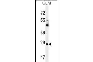 TI Antibody (C-term) (ABIN655149 and ABIN2844770) western blot analysis in CEM cell line lysates (35 μg/lane). (TIMP1 anticorps  (C-Term))