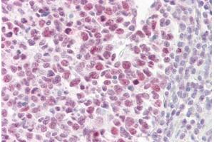 Anti-PIAS4 antibody IHC staining of human tonsil. (PIAS4 anticorps  (AA 451-500))