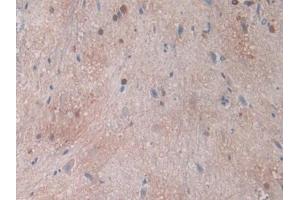 Detection of CA2 in Rat Spinal cord Tissue using Polyclonal Antibody to Carbonic Anhydrase II (CA2)