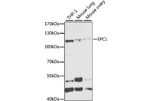 Western blot analysis of extracts of various cell lines, using EPC1 antibody (ABIN6133506, ABIN6140203, ABIN6140204 and ABIN6221494) at 1:1000 dilution. (EPC1 anticorps  (AA 1-300))