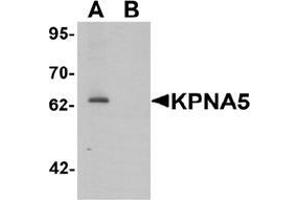 Western blot analysis of KPNA6 in EL4 cell lysate with KPNA5 Antibody  at 1 μg/mL in (A) the absence and (B) the presence of blocking peptide.