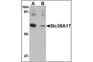 Western blot analysis of Slc22A17 in SK-N-SH lysate with this product at 1 μg/ml in (A) the absence and (B) the presence of blocking peptide.
