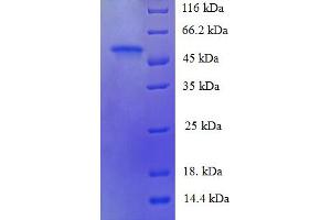 SDS-PAGE (SDS) image for PDZ Domain Containing 1 (PDZK1) (AA 1-519), (full length) protein (His tag) (ABIN5711403)