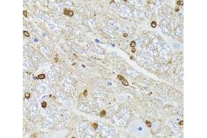 Immunohistochemistry of paraffin-embedded Mouse brain using TPPP Polyclonal Antibody at dilution of 1:100 (40x lens). (Tppp anticorps)