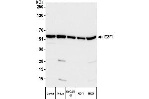Western Blotting (WB) image for anti-E2F Transcription Factor 1 (E2F1) (AA 387-437) antibody (ABIN7452199)