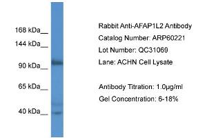 Western Blotting (WB) image for anti-Actin Filament Associated Protein 1-Like 2 (AFAP1L2) (N-Term) antibody (ABIN2788372) (AFAP1L2 anticorps  (N-Term))