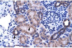 Human kidney; ZNF84 antibody - C-terminal region in Human kidney cells using Immunohistochemistry (ZNF84 anticorps  (C-Term))