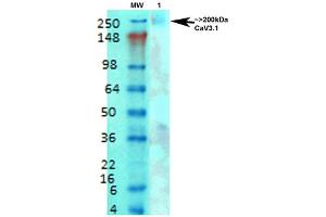 Western Blot analysis of Rat brain membrane lysate showing detection of Cav3. (CACNA1G anticorps  (AA 2052-2172) (PE))