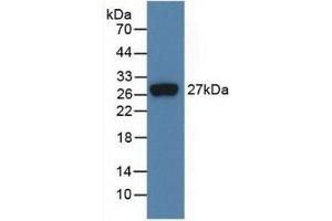 Detection of Recombinant FGF21, Human using Monoclonal Antibody to Fibroblast Growth Factor 21 (FGF21) (FGF21 anticorps  (AA 29-209))