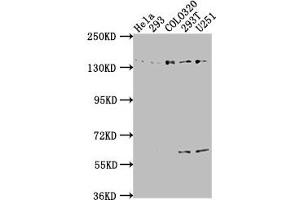 Western Blot Positive WB detected in: Hela whole cell lysate, 293 whole cell lysate, COLO320 whole cell lysate, 293T whole cell lysate, U251 whole cell lysate All lanes: ERC1 antibody at 1:2000 Secondary Goat polyclonal to rabbit IgG at 1/50000 dilution Predicted band size: 129, 114, 125, 109, 82 kDa Observed band size: 135 kDa (ERC1 anticorps  (AA 1-224))