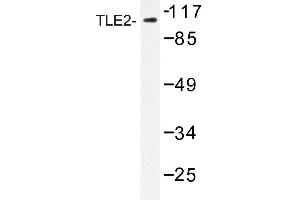 Image no. 1 for anti-Transducin-Like Enhancer Protein 2 (TLE2) antibody (ABIN272212) (TLE2 anticorps)