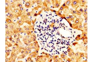 IHC image of ABIN7170921 diluted at 1:400 and staining in paraffin-embedded human liver tissue performed on a Leica BondTM system.