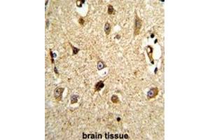 Immunohistochemistry (IHC) image for anti-Valosin Containing Protein (VCP) antibody (ABIN3002881) (VCP anticorps)