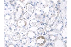 Detection of CK2 in Human Kidney Tissue using Polyclonal Antibody to Keratin 2 (CK2)