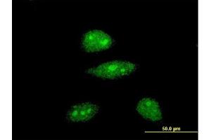 Immunofluorescence of monoclonal antibody to HEY1 on HeLa cell. (HEY1 anticorps  (AA 121-220))