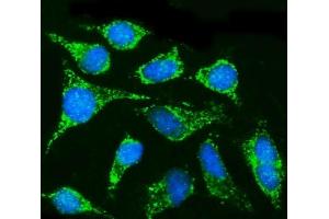 IF analysis of CPT1B using anti-CPT1B antibody (ABIN7600359). (CPT1B anticorps  (AA 180-772))